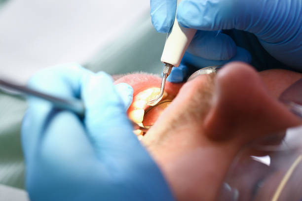 Best Emergency Cosmetic Dentistry (e.g., broken veneers) in Paducah, KY